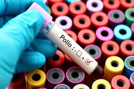 اسلام آباد میں 16 سال کے بعد پہلی بار پولیو کا کیس رپورٹ