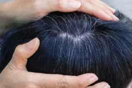 کم عمری میں بال سفید ہونے کی بنیادی وجوہات