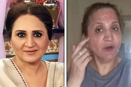اداکارہ اسما عباس کو جلد کا علاج مہنگا پڑ گیا، چہرے پر الرجی اور خارش کی شکایت