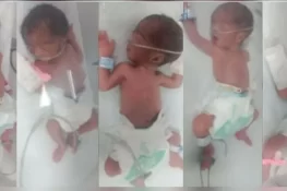 کراچی میں ایک خاتون کے ہاں بیک وقت پانچ بچوں کی پیدائش، والد نے تعاون کی اپیل کر دی