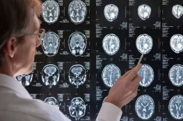 ایم آر آئی اسکین : 40 کی دہائی میں عمر اور بیماریوں کا پتا لگانا ممکن