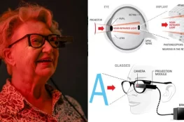 دنیائے طب میں انقلاب: جسم میں نصب کمپیوٹر چِپس سے بینائی جزوی طور پر بحال