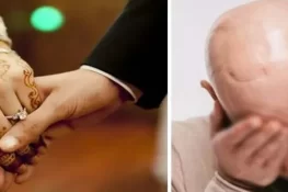 شوہر کے گنجے ہونے کا جھانسہ، بیوی نے شوہر اور سسرالیوں کے خلاف ایف آئی آر درج کرادی